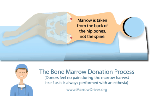 Marrow Donation Illustration